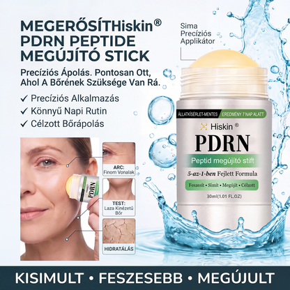 𝑯𝒊𝒔𝒌𝒊𝒏® 🛒 𝑷𝑫𝑹𝑵 Ö𝒓𝒆𝒈𝒆𝒅é𝒔𝒈á𝒕𝒍ó & 𝑪é𝒍𝒛𝒐𝒕𝒕 𝑭𝒐𝒍𝒕𝒎𝒆𝒈ú𝒋í𝒕ó 𝑺𝒕𝒊𝒇𝒕（𝑺𝒆𝒈í𝒕 𝒌𝒊𝒔𝒊𝒎í𝒕𝒂𝒏𝒊 𝒂 𝒓á𝒏𝒄𝒐𝒌 𝒎𝒆𝒈𝒋𝒆𝒍𝒆𝒏é𝒔é𝒕, 𝒕á𝒎𝒐𝒈𝒂𝒕𝒋𝒂 𝒂 𝒇𝒆𝒔𝒛𝒆𝒔𝒆𝒃𝒃𝒏𝒆𝒌 𝒕ű𝒏ő 𝒃ő𝒓𝒕, é𝒔 𝒔𝒆𝒈í𝒕 𝒋𝒂𝒗í𝒕𝒂𝒏𝒊 𝒂 𝒍á𝒕𝒉𝒂𝒕ó 𝒇𝒐𝒍𝒕𝒐𝒌 𝒎𝒆𝒈𝒋𝒆𝒍𝒆𝒏é𝒔é𝒕）🌼（副本）