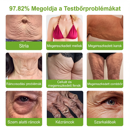 𝑯𝒊𝒔𝒌𝒊𝒏® 🛒 𝑷𝑫𝑹𝑵 Ö𝒓𝒆𝒈𝒆𝒅é𝒔𝒈á𝒕𝒍ó & 𝑪é𝒍𝒛𝒐𝒕𝒕 𝑭𝒐𝒍𝒕𝒎𝒆𝒈ú𝒋í𝒕ó 𝑺𝒕𝒊𝒇𝒕（𝑺𝒆𝒈í𝒕 𝒌𝒊𝒔𝒊𝒎í𝒕𝒂𝒏𝒊 𝒂 𝒓á𝒏𝒄𝒐𝒌 𝒎𝒆𝒈𝒋𝒆𝒍𝒆𝒏é𝒔é𝒕, 𝒕á𝒎𝒐𝒈𝒂𝒕𝒋𝒂 𝒂 𝒇𝒆𝒔𝒛𝒆𝒔𝒆𝒃𝒃𝒏𝒆𝒌 𝒕ű𝒏ő 𝒃ő𝒓𝒕, é𝒔 𝒔𝒆𝒈í𝒕 𝒋𝒂𝒗í𝒕𝒂𝒏𝒊 𝒂 𝒍á𝒕𝒉𝒂𝒕ó 𝒇𝒐𝒍𝒕𝒐𝒌 𝒎𝒆𝒈𝒋𝒆𝒍𝒆𝒏é𝒔é𝒕）🌼（副本）