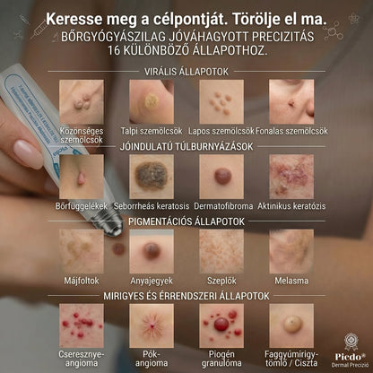 𝐇𝐢𝐯𝐚𝐭𝒂𝒍𝒐𝒔 𝒎á𝗿𝗸𝗮𝗯𝗼𝗹𝐭 | 🖊️ 𝐏i𝐜𝐝𝐨® 𝟕 𝐧𝐚𝒑𝒐𝒔 𝒔𝒛𝗲𝗺ö𝗹𝗰𝘀- é𝐬 𝐟𝐨𝐥𝐭𝐞𝐥í𝐭ó (𝐟á𝐣𝐝𝐚𝐥𝒐𝒎𝒎𝒆𝒏𝒕𝒆𝒔, 𝒉𝒆𝗴 𝗻é𝗹𝗸ü𝐥𝐢 𝐠𝐨𝐥𝐲ó𝐬 𝐚𝐩𝐩𝐥𝐢𝐤á𝐭𝐨𝐫)🎄